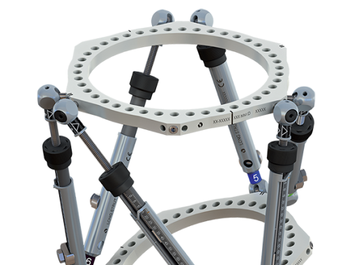 TL-HEX TrueLok Hexapod System - Orthofix